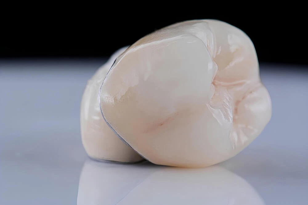 Ceramic Dental Porcelain Veneers and Crowns