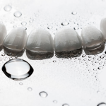 Porcelain Dental Veneers