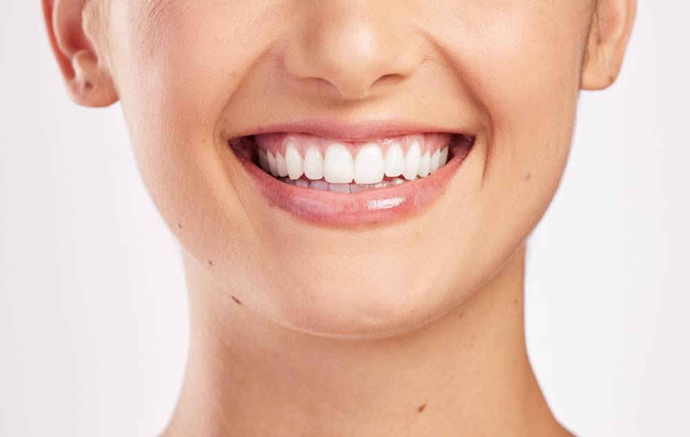 Woman smiling & showing white teeth