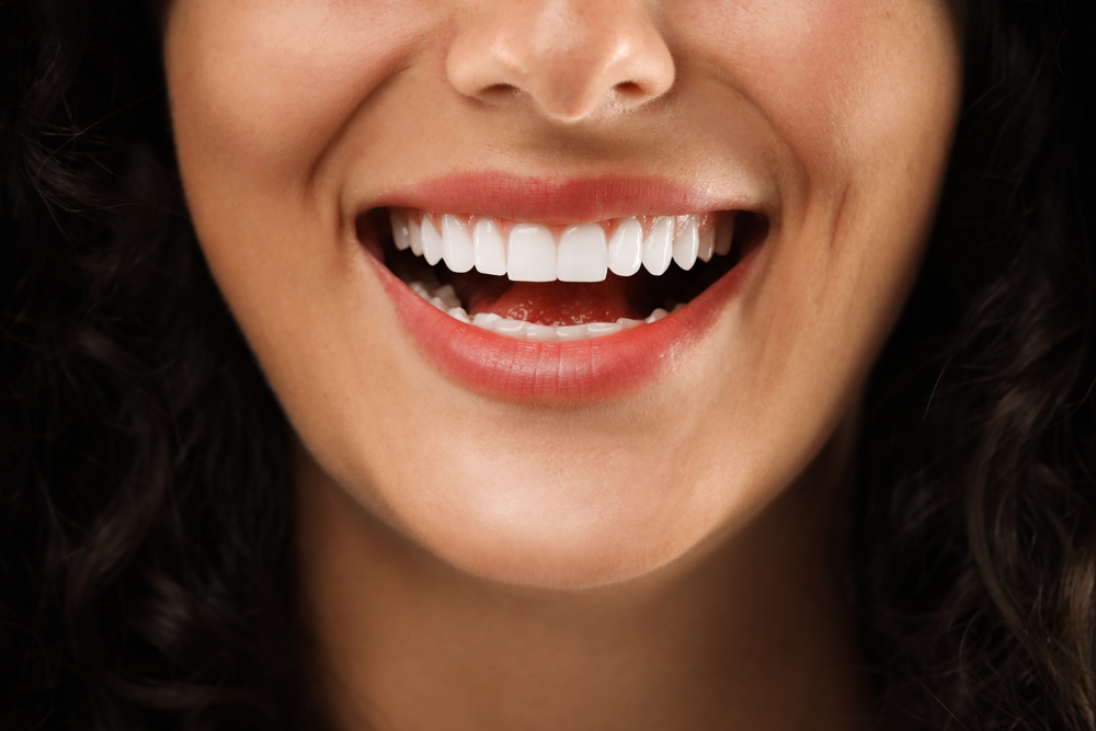 Woman smiling with bright white teeth and healthy gums